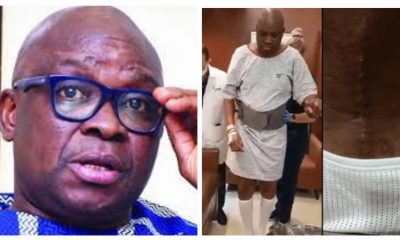 FAYOSE