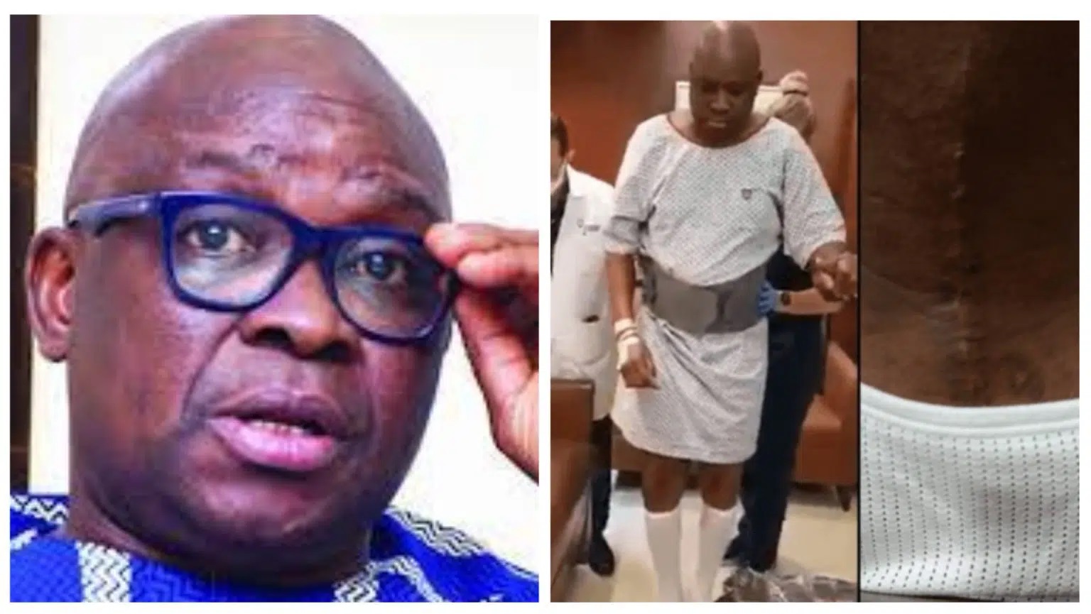 FAYOSE