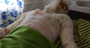Gas Explosion