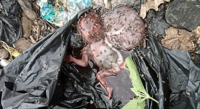 foetus