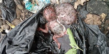 foetus