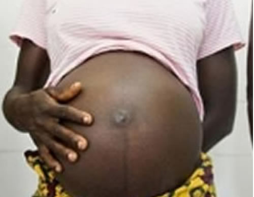 Teacher Impregnates JSS2 Student
