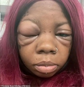 Mother Of Five Going Blind