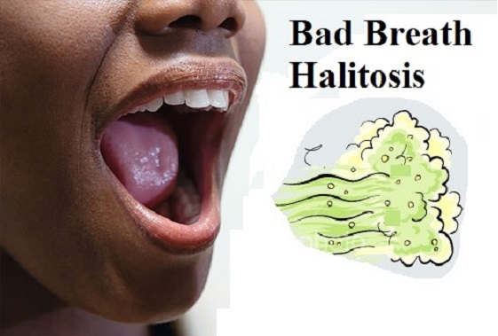 Mouth Odor and it Control