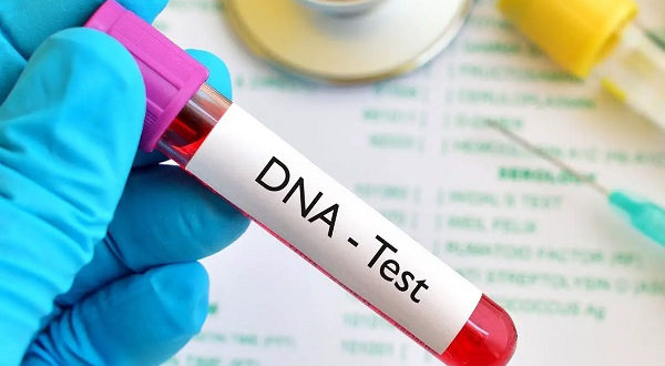 DNA Test
