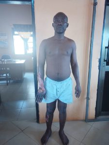 Pastor Suspected of Burning Married Woman