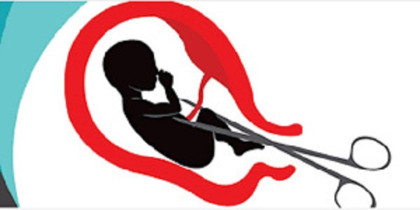 Aborting 8-month-old Pregnancy