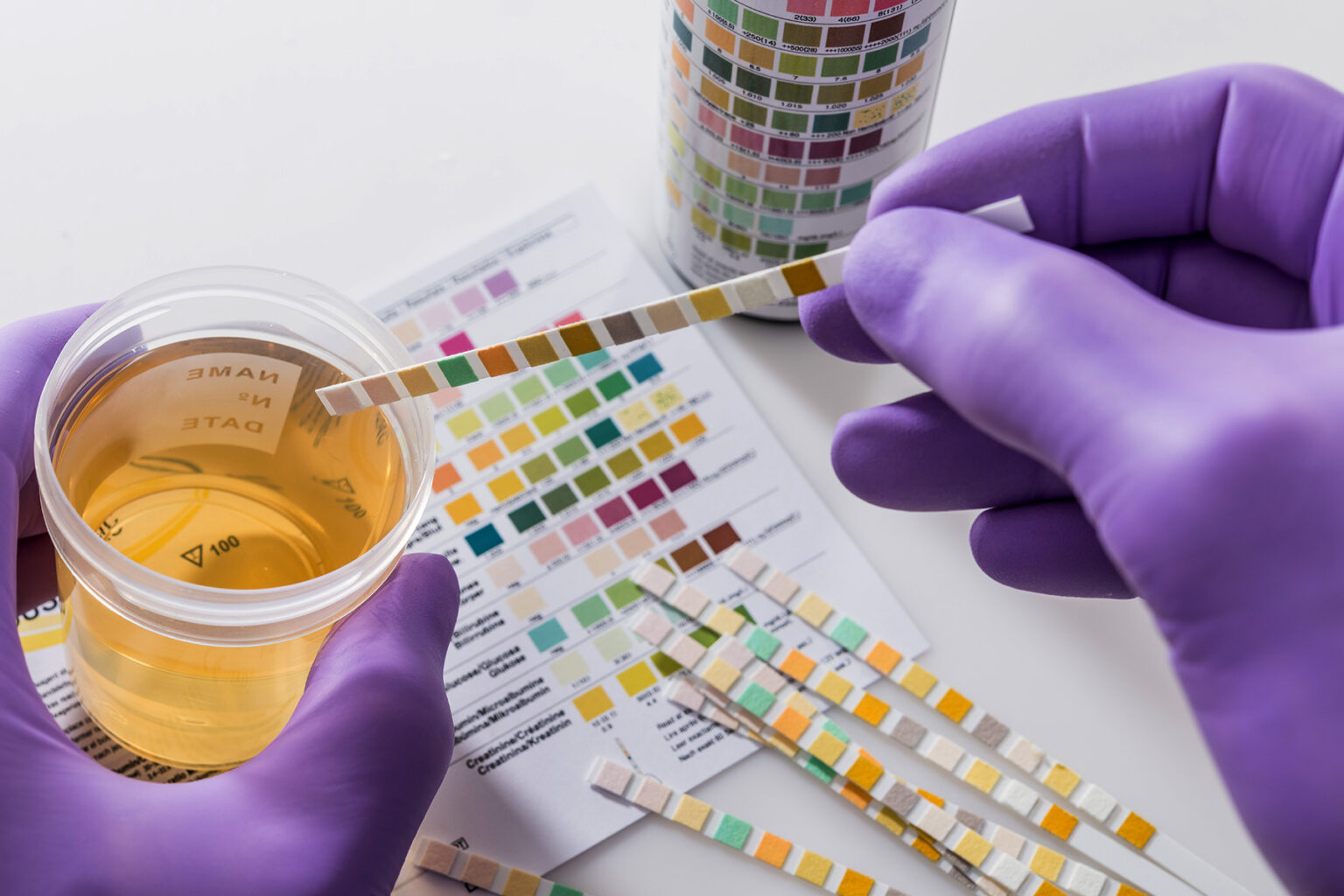 Failing Drug Tests